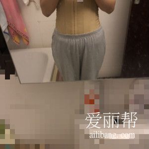 深圳腰腹环吸术后效果图谁还不是小蛮腰呢