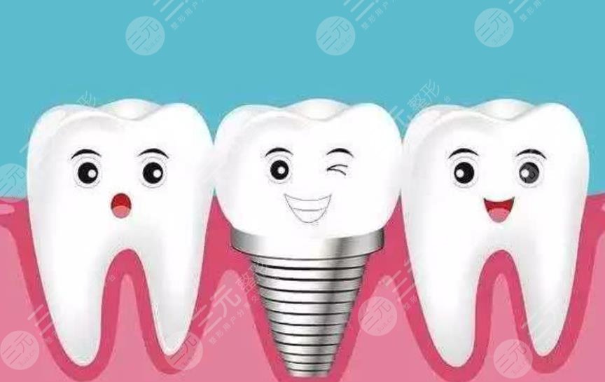  Can I use disease insurance for dental implants in Shanghai Stomatological Hospital