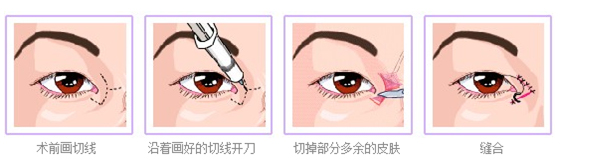  Huainan Beauty Plastic Surgery Hospital Hot Price List First