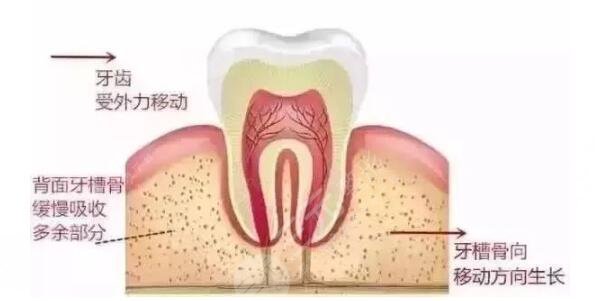  Which is the best one in Wenzhou Dental Implant Hospital