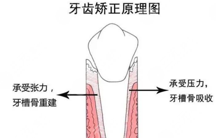  Which hospital is better for Guangzhou orthodontics