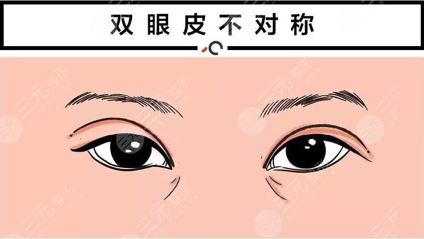  Eight pictures of eyelid failure