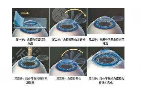  2022 Which hospital in Wuhan is better in ophthalmology