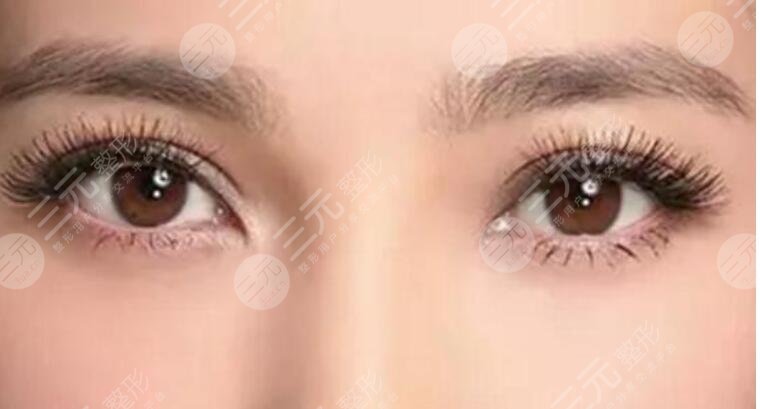  How long will it take to return to normal after total eyelid removal