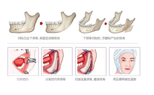  What is the price of face modification in Peking Union Medical College Plastic Surgery Hospital