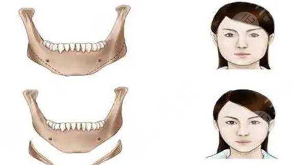  Who Is Strong in Shanghai Maxillofacial Surgery