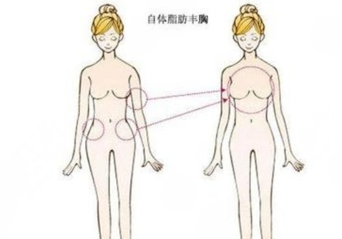  Which doctor of Shanghai Ninth Hospital is better for breast augmentation