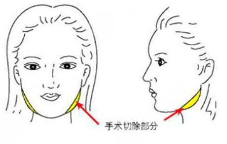  Chengdu plastic surgeon