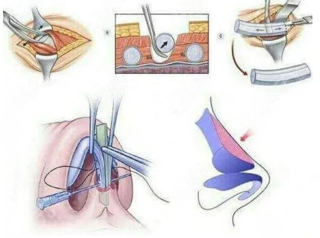  How about the reputation of Shenzhen Sunshine Plastic and Cosmetic Hospital