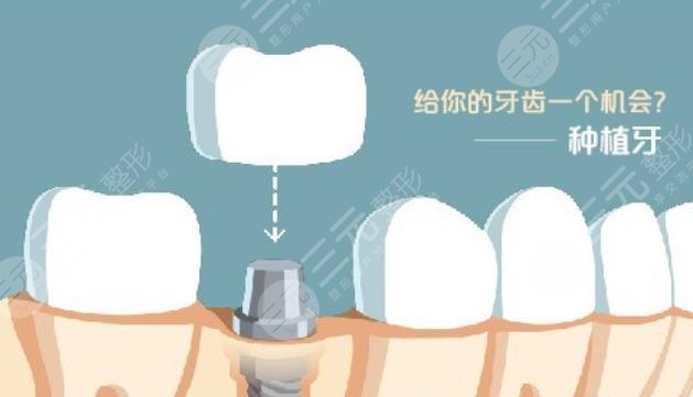  2022 Shanghai Dental Implant Hospital Ranking Update