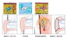  How about the beauty and plastic surgery department of the First Hospital of Harbin Medical University