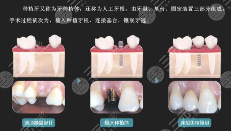  2022 Guangzhou's cheap and good dental ranking update