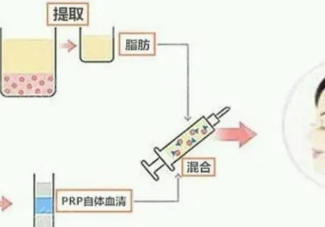  2022 Beijing Auto Fat Filling Doctors Ranking Announcement