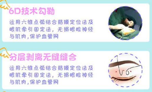  Which doctor is better for Foshan to cut double eyelid