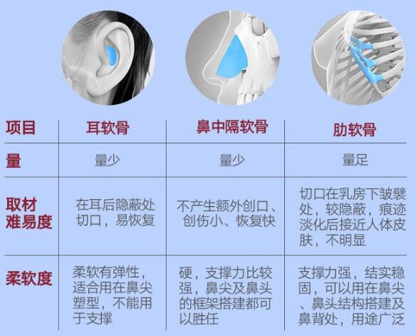  How about Hangzhou Huashan Cheng Lin's nose