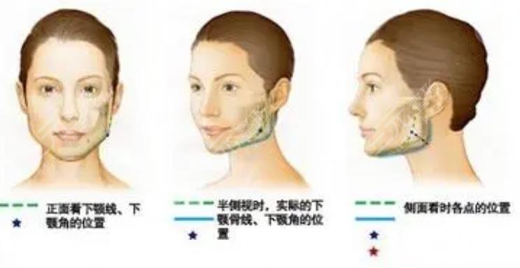  Ranking list of Beijing regular plastic surgery hospitals