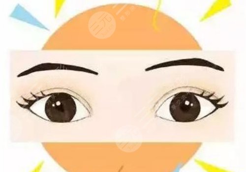  How long will it take to recover from double eyelid surgery