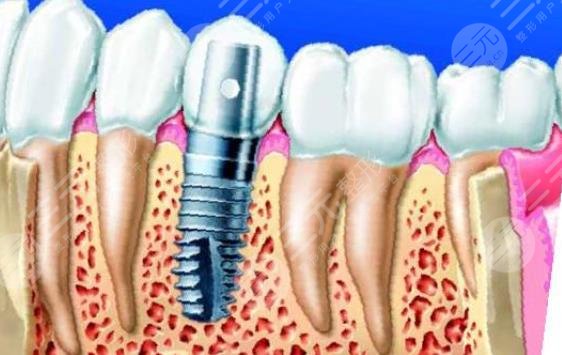  2022 Guangzhou's cheap and good dental ranking update