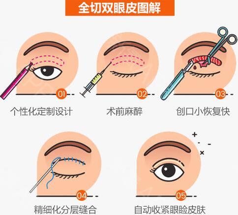  Which is better, a double eyelid doctor of Zhongshan First Hospital