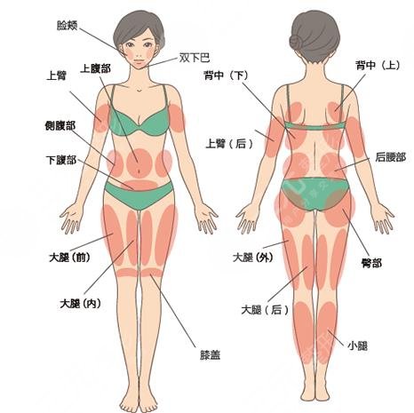 吸脂手术怎么样