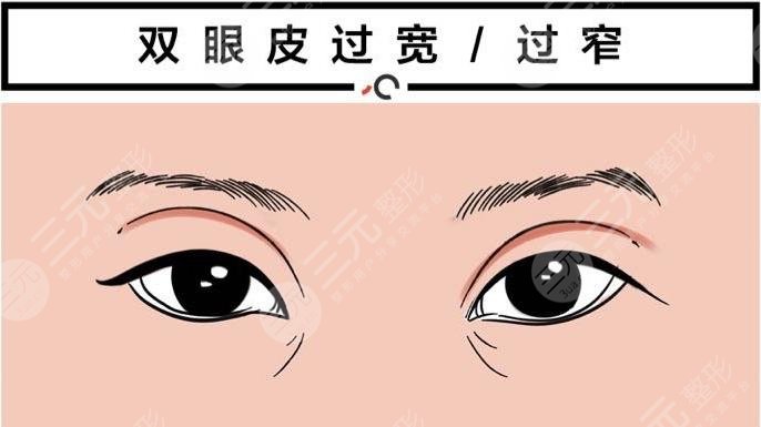  Eight pictures of eyelid failure