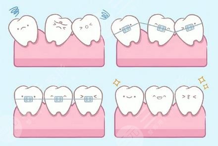  Is Dr. Qi Zhen of the Orthodontics Department of Zhongshan People's Hospital skilled