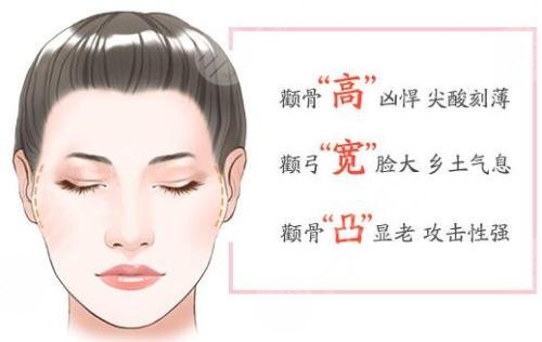  How much is the general price of internal push of zygomatic bone in Shanghai