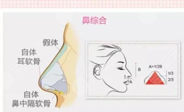  Where is Shenzhen good at nose making