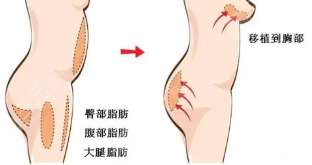  Which is a good public plastic surgery hospital in Guangzhou