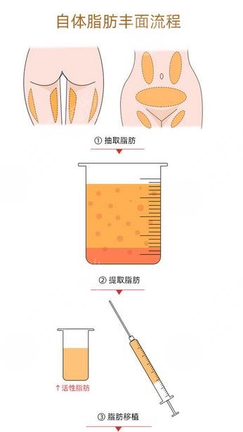  Shanghai Fat Filling Hospital Ranking 2022 Update