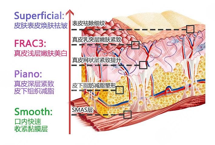  Which is better, Shenzhen United Rigor or Meilai