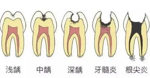 哈医大一院种牙怎么样