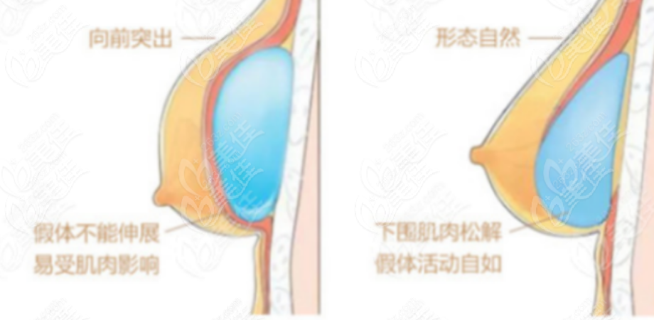  Ranking of Top Ten Breast Augmentation Hospitals in Xi'an Released