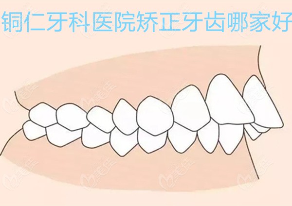  Tongren Dental Hospital, which one is better for orthodontics