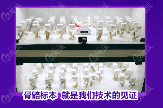  How much is the mandibular angle grinding surgery in Guangzhou