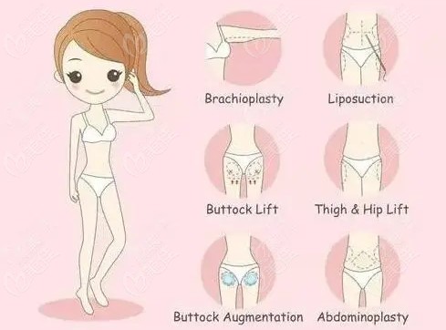  How much is the liposuction operation in Guiyang