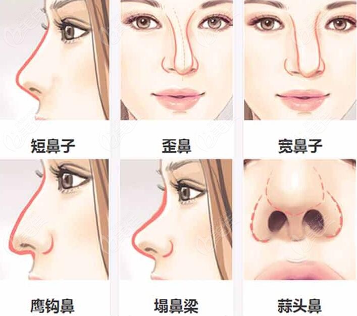  Top 10 doctors who have done a good job in Beijing's rhinology