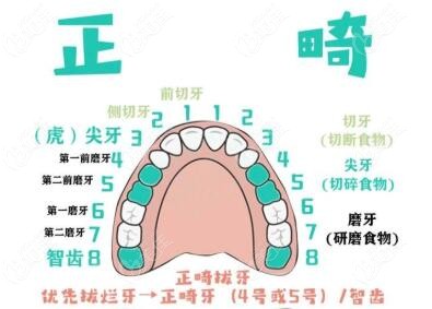 牙齿矫正需要拔牙