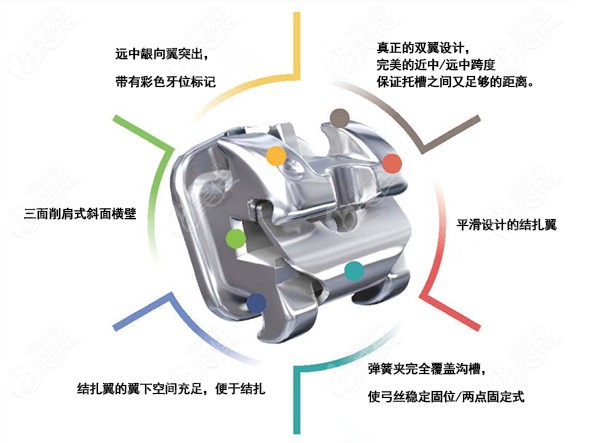 登士柏自锁托槽怎么样