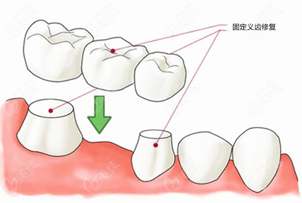  Tangshan dentistry is good or cheap