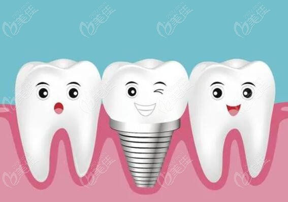  Yibin Dental Charging Standard