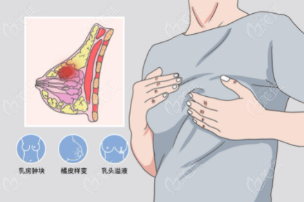  What's the price of breast augmentation in Fujian