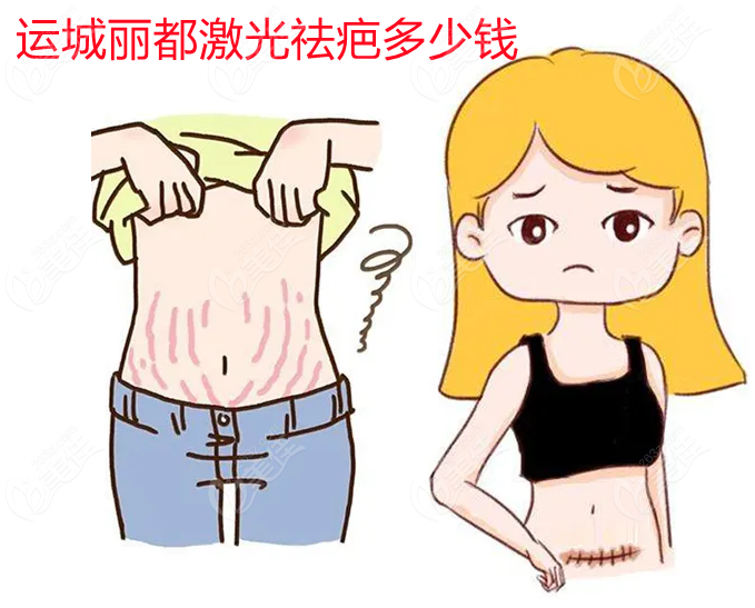  Which hospital is better for Yuncheng laser scar removal