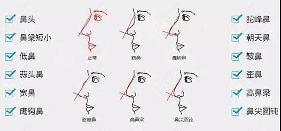  The hospital in Ma'anshan, which is good at prosthetic rhinoplasty, gives the general plastic surgery of expanding body and rhinoplasty about how much it costs