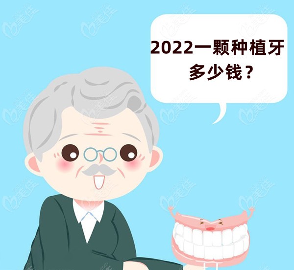 2022一颗种植牙多少钱