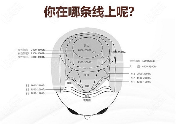 超话巴掌大植发