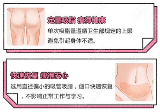  Which doctor in Hefei Huamei is better at liposuction