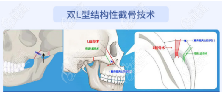  Which hospital is good for Xi'an Mogu