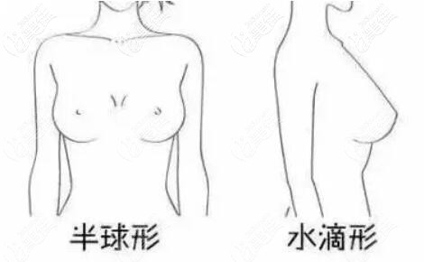  Before breast augmentation, I heard that the hand feeling of water drop prosthesis is not as good as that of round prosthesis