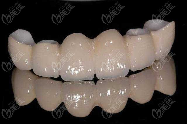  2022 Yuncheng baked all ceramic teeth price list has been updated